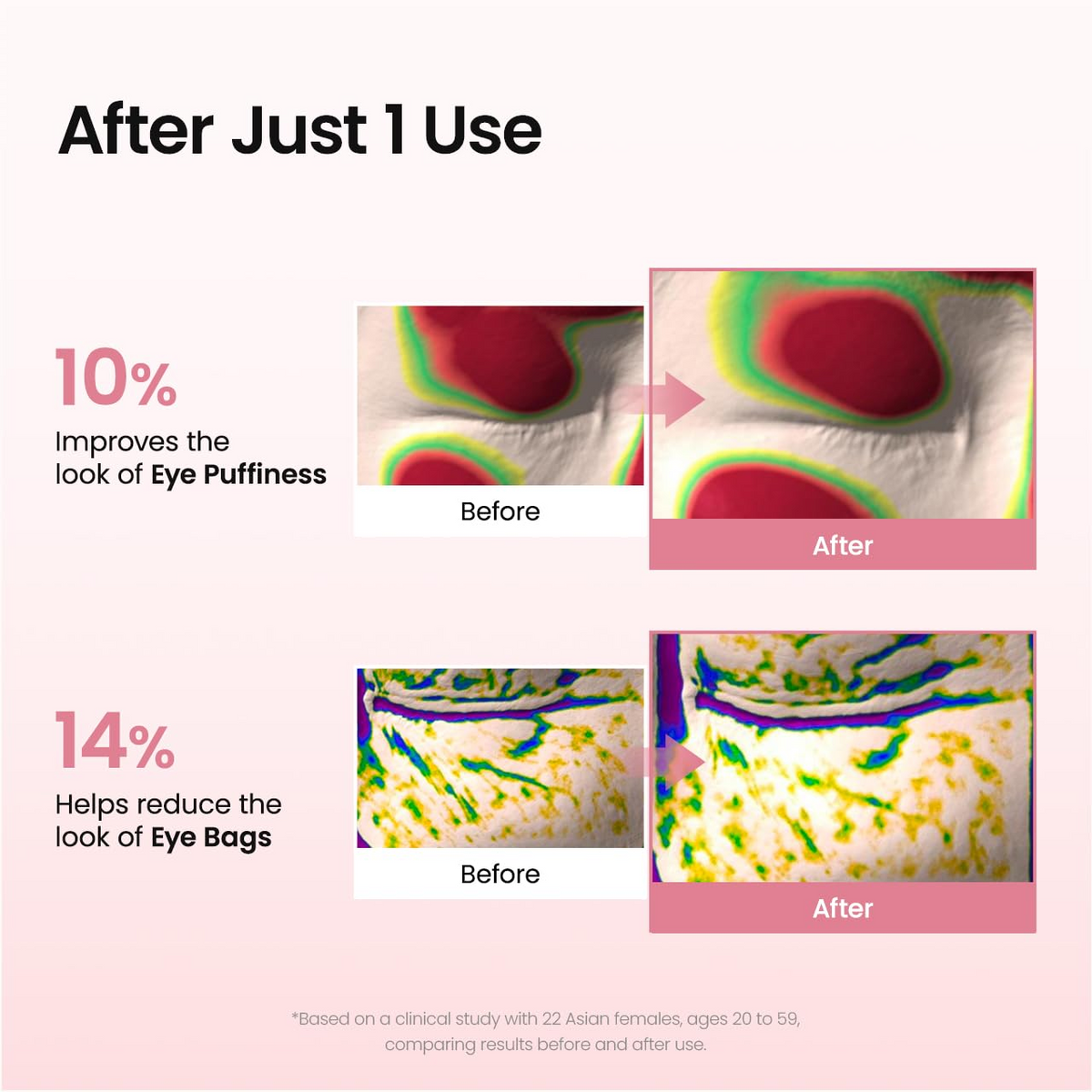 Hydrogel Under Eye Patches – Collagen Peptide Eye Masks for Fine Lines & Wrinkles, 60 Count