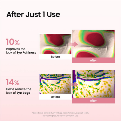 Hydrogel Under Eye Patches – Collagen Peptide Eye Masks for Fine Lines & Wrinkles, 60 Count